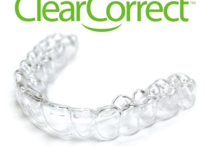Flash Smile Dental provides ClearCorrect teeth protector.