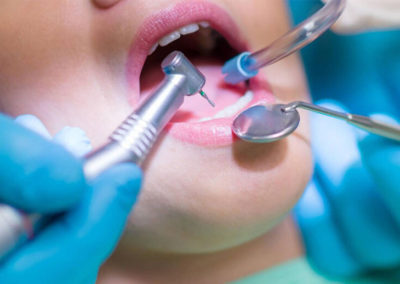Flash Smile Dental providing Oral Surgery.